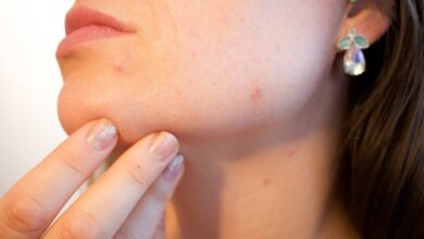 Photo of Эксперты назвали необычные признаки рака кожи