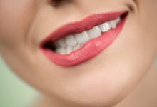 Photo of Почему при протезировании зубов лучше выбирать циркониевые коронки: объясняет стоматолог Михаил Тымко