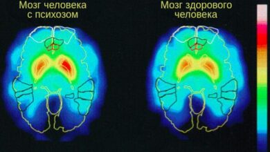 Photo of Патогенез острого психотического расстройства