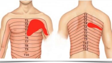 Photo of Как проявляется и лечится межреберная невралгия?
